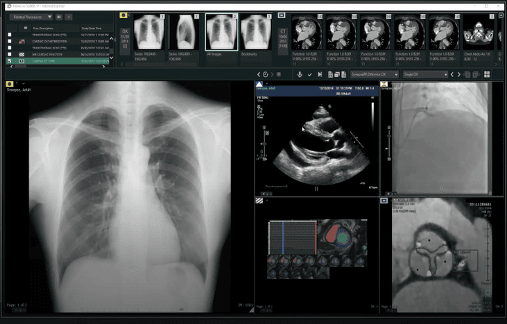Synapse PACS - Image 2