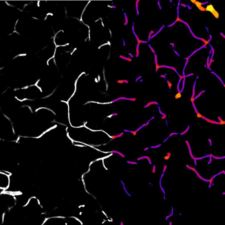 Reseau vasculaire : image native (fluorescence) // Réseau vasculaire : carte d’épaisseur © Corinne BARREAU, Audrey VARIN & Mathieu VIGNEAU (RESTORE)