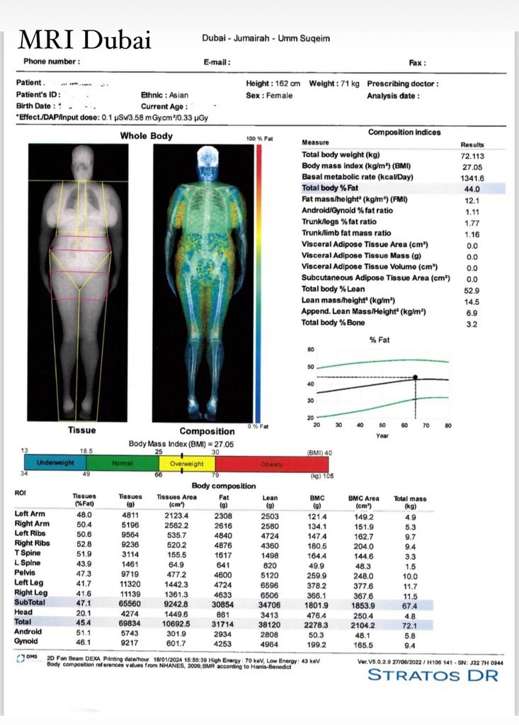 Dexa scan dubai