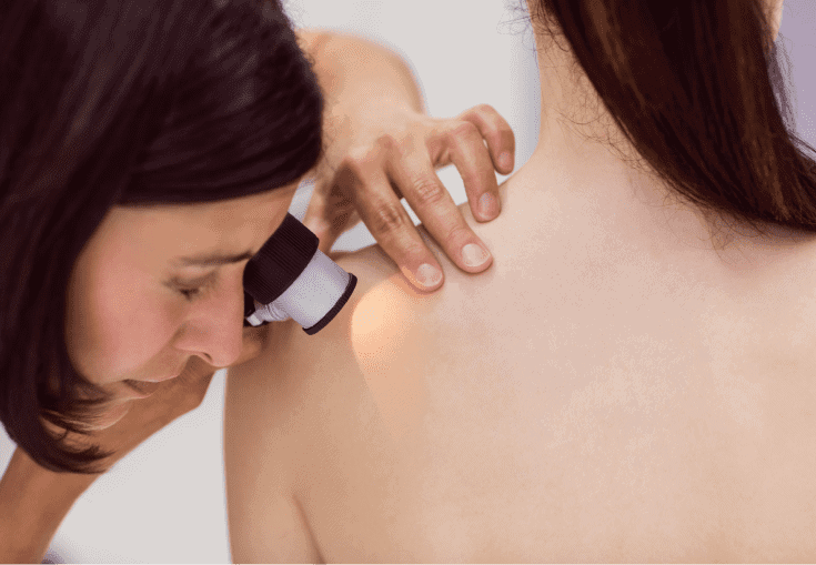 Dermatóloga examinando una lesión con dermatoscopio