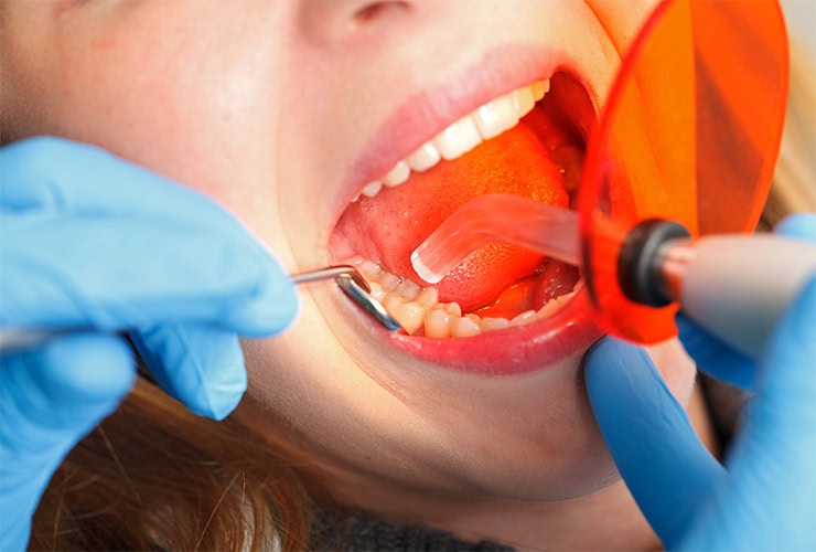 Services---Restorative-dentistry