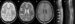 MRI brain scan