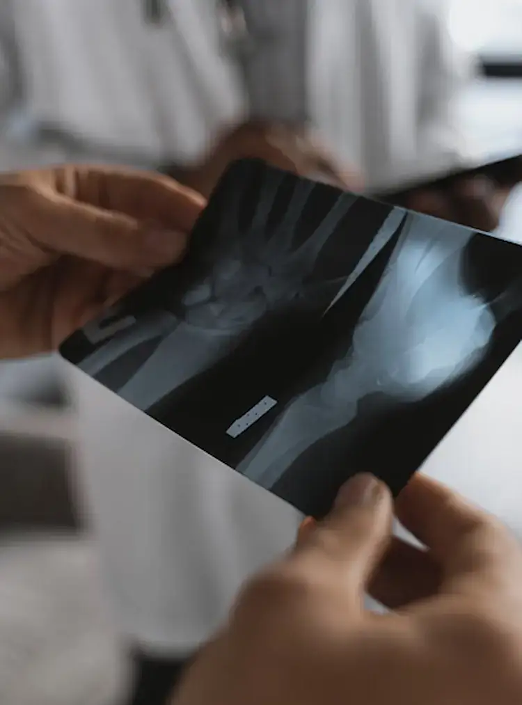 xCures automatically surfaces the documentation that supports medical necessity for testing.