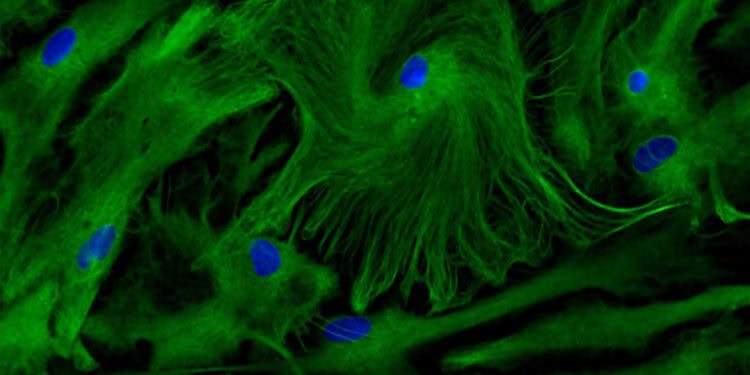 Culture of astrocytes from the visual cortex of young mice aged 1 to 3 days. (Credit: Inserm/Ruiz, Anne-Laure)