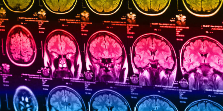 (Photo credit: Adobe Stock)