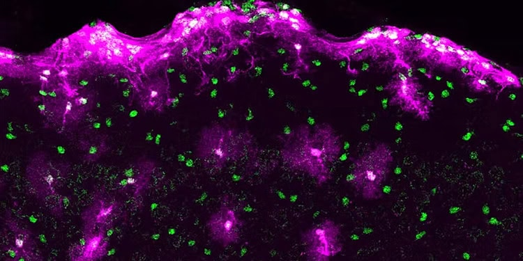 The loss and degeneration of astrocytes are present in many neurodegenerative conditions. (Photo credit: Sabrina Chierzi)