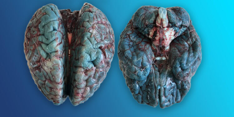Greenish-blue
discoloration of brain after
contact with atmospheric oxygen. [Credit: Carlos Durão et al.]
