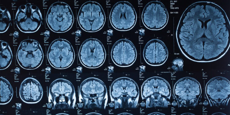Brain scan MRI images showing detailed views of brain structures for neurological and psychological research.