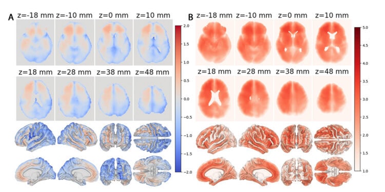AI-generated maps of local brain aging; cooler colors indicate brain regions that appear younger relative to a person's chronological age, whereas warmer colors indicate regions that appear older. Compared with cognitively normal adults (left), people with cognitive impairment (right) show substantially more widespread patterns of advanced local brain aging, particularly in frontal and temporal brain regions. [Andrei Irimia Laboratory, University of Southern California]