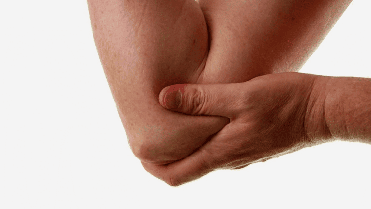 Cubital Tunnel Syndrome