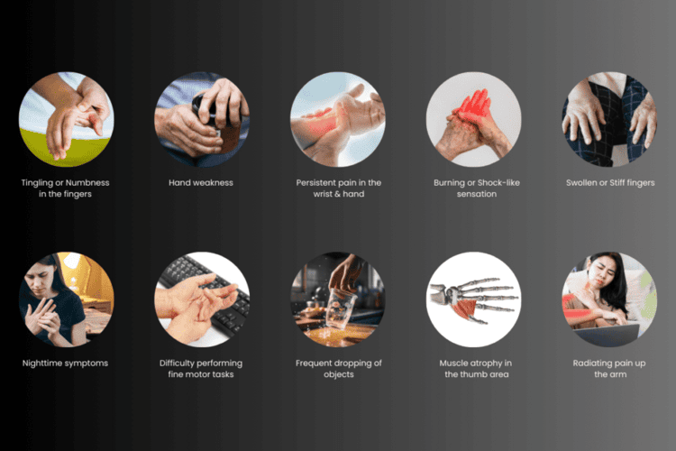 10 warning signs of carpal tunnel syndrome you shouldn’t ignore