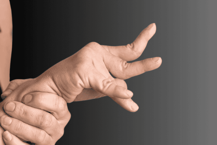 Cerebral palsy & Spastic hand and સેરેબ્રલ પાલ્સી અને સ્પાસ્ટિક હેન્ડ