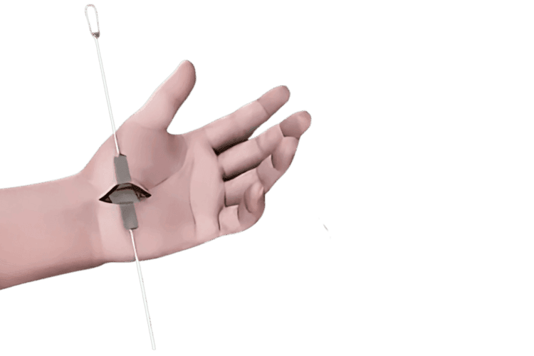 Orthopedic hand surgery