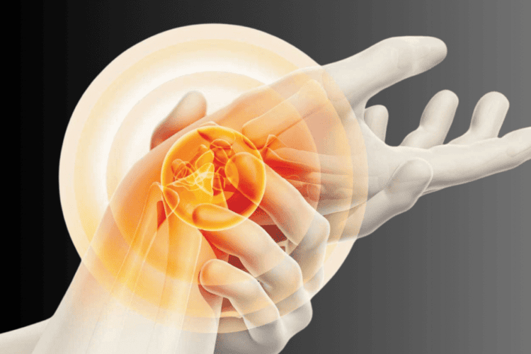 Does carpal tunnel syndrome resolve on its own?
