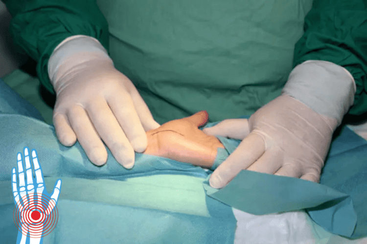 How to choose the best carpal tunnel specialist