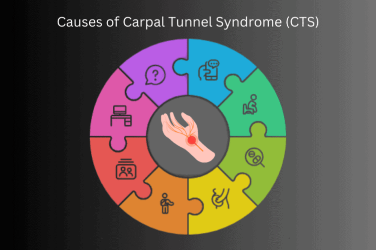 What causes carpal tunnel syndrome?