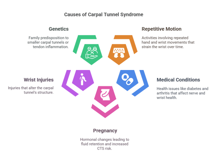 Causes of carpal tunnel syndrome