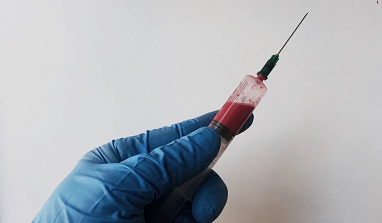 examen pcr coravirus covid-2019 comuna de maipu