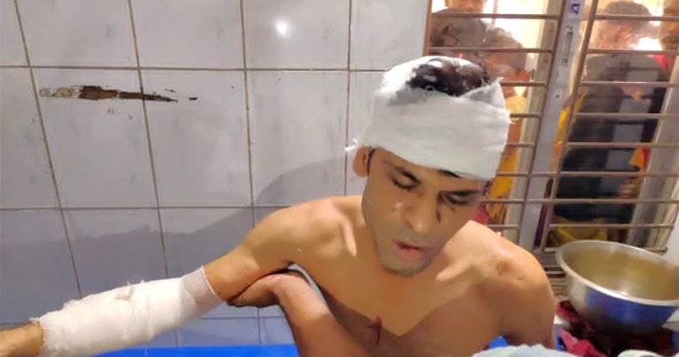রায়পুরায় সাংবাদিককে পিটিয়ে ও গুলি করে আহত; আশঙ্কাজনক অবস্থায় ঢাকায় প্রেরণ