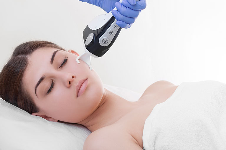 acne scar laser
