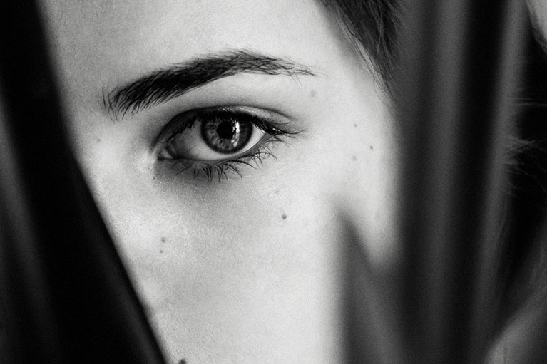 Black and white picture with a women's face having mole