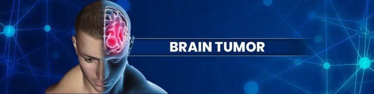 Homeopathy-Treatment-for-Brain-tumor