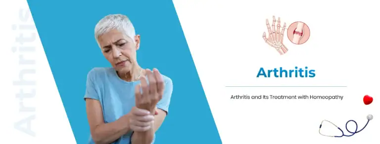 arthritis treatment with homeopathy