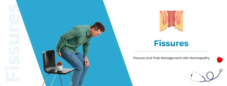 anal fissures treatment with homeopathy