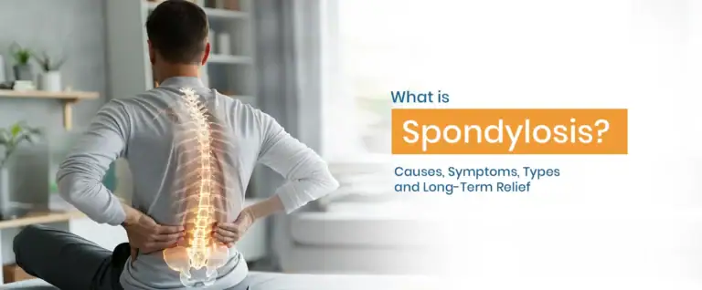 Spondylosis
