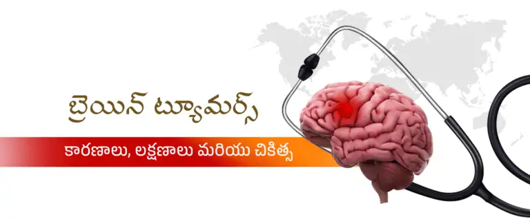 brain-tumors