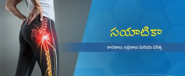 సయాటికా