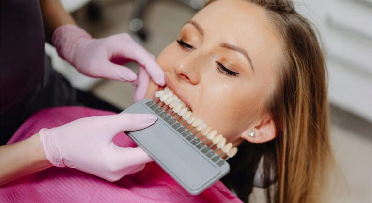 Teeth Whitening: What Works and What to Avoid