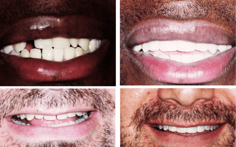 Cosmetic Dentistry is more popular than ever before, but can it Change Your Life?