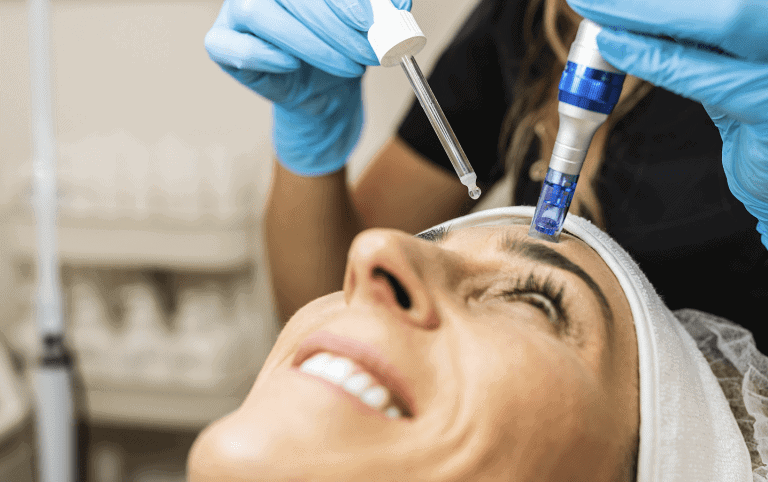 microneedling