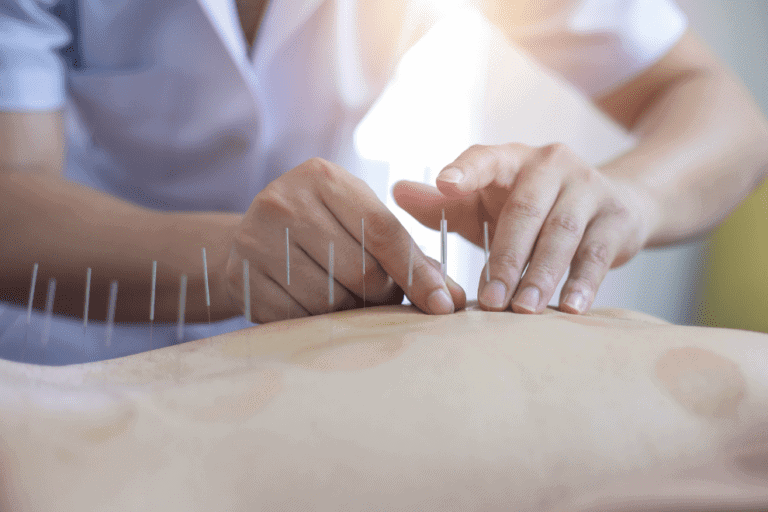 acupuntura medica sao paulo3