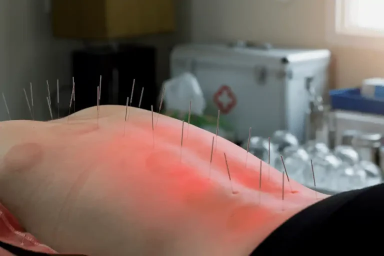 acupuntura medica sao paulo33