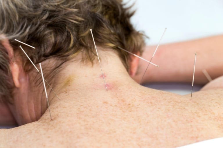 acupuntura medica sao paulo4