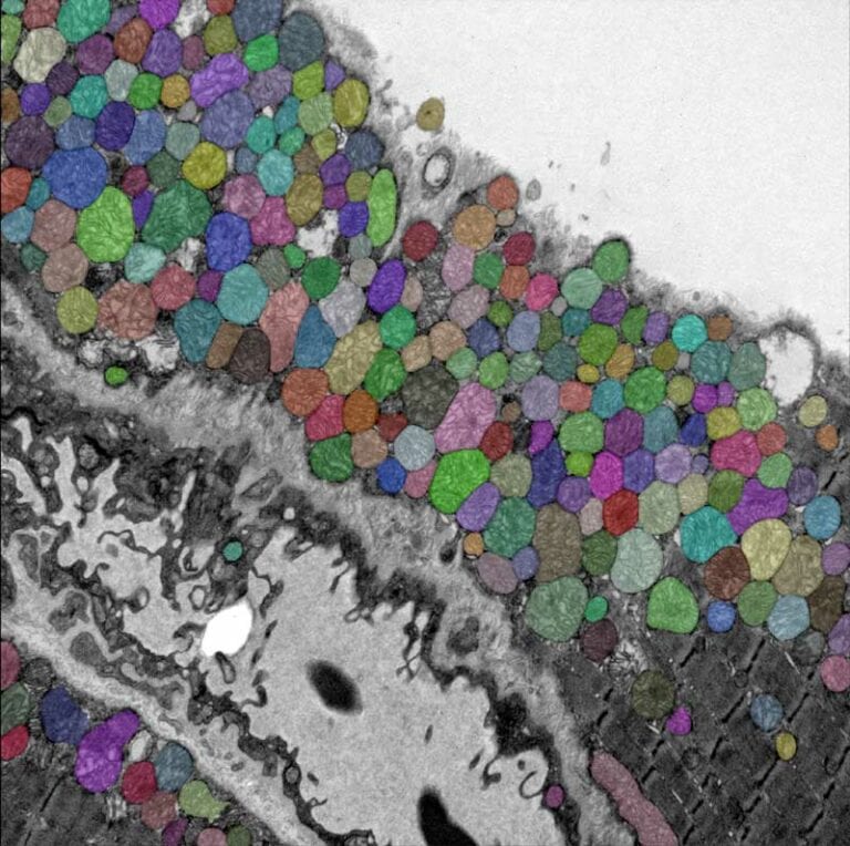 Sur ces images, on voit que l’algorithme d’IA est capable de détecter précisément les mitochondries (en couleurs), à partir de tissus musculaires d’humains, de vers, de souris et poissons imagés en microscopie électronique © Mathieu Vigneau & Jean-Philippe Pradère (RESTORE) / Bruno Payré & Stéphanie Balor (CMEAB) Source : Morin et al., Nature Metabolism (2025)