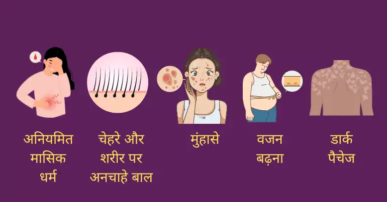 Infographic listing health concerns: irregular mental health issue, unwanted hair on face and body, acne, weight gain, and dark patches on the skin.