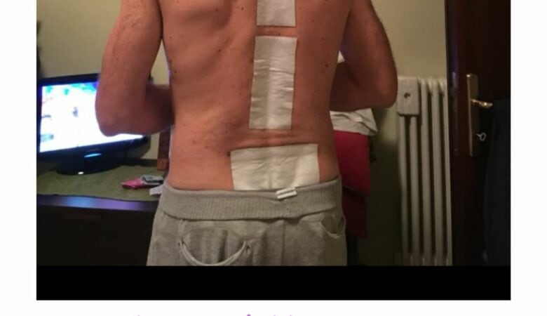 Il valore delle persone va oltre le sue cicatrici