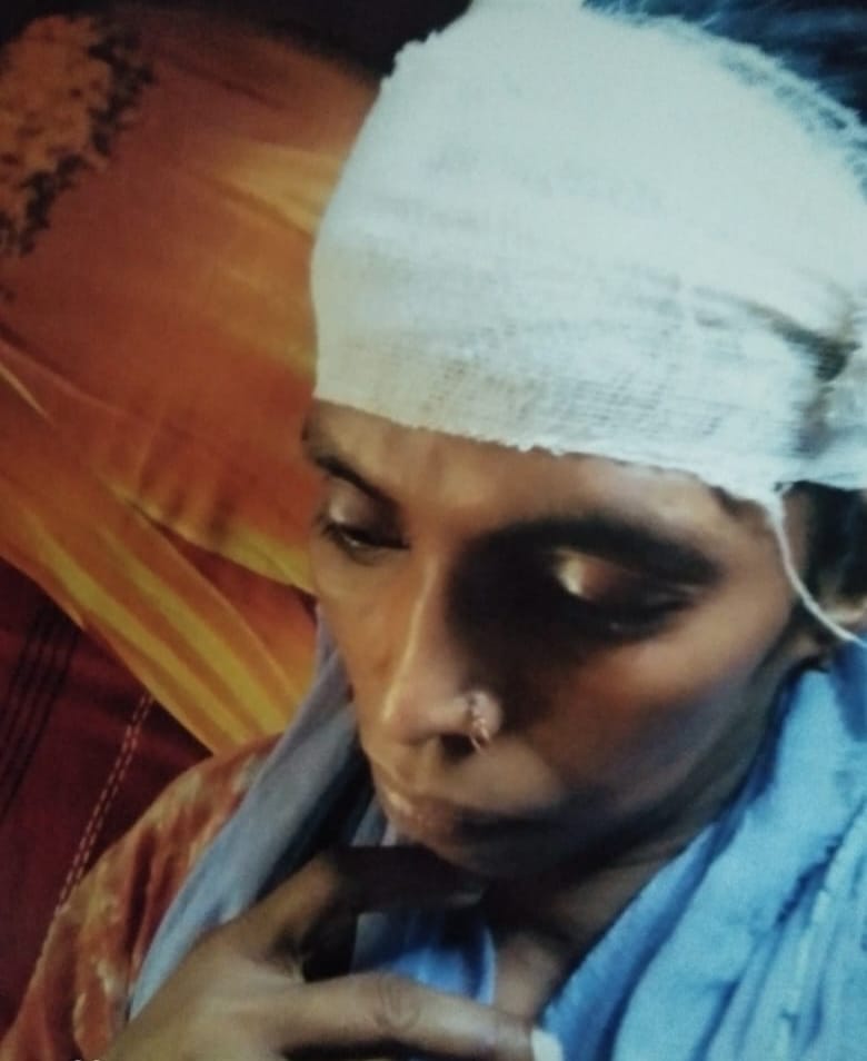 যাত্রাবাড়ী মাতুয়াইলে সম্পত্তির লোভে ছোট বোনকে হত্যা চেষ্টায় মামলা