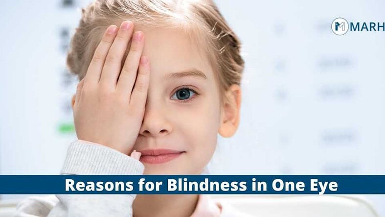 Blind in One Eye: Causes and Treatment | Marham