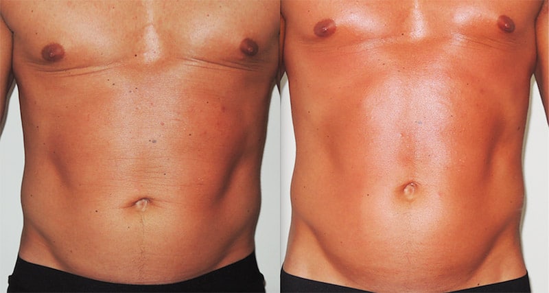 Ein definierter Bauch für den Mann