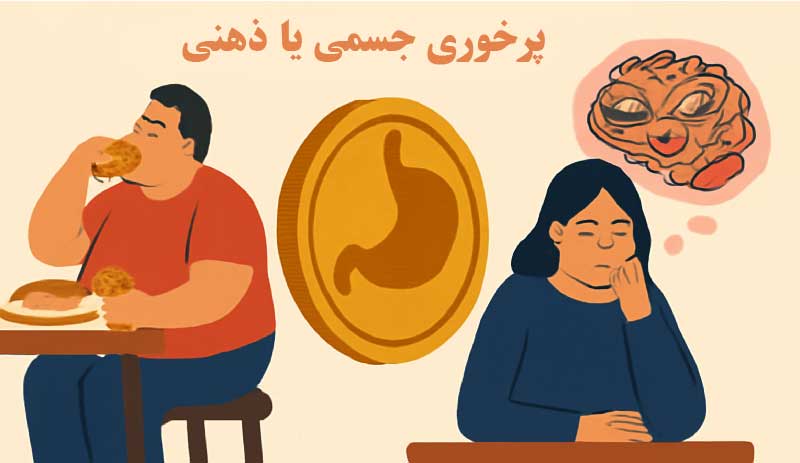 ارتباط مغز و پرخوری عصبی