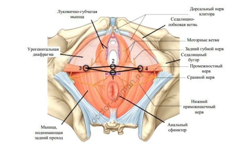 Нитевая перинеопластика