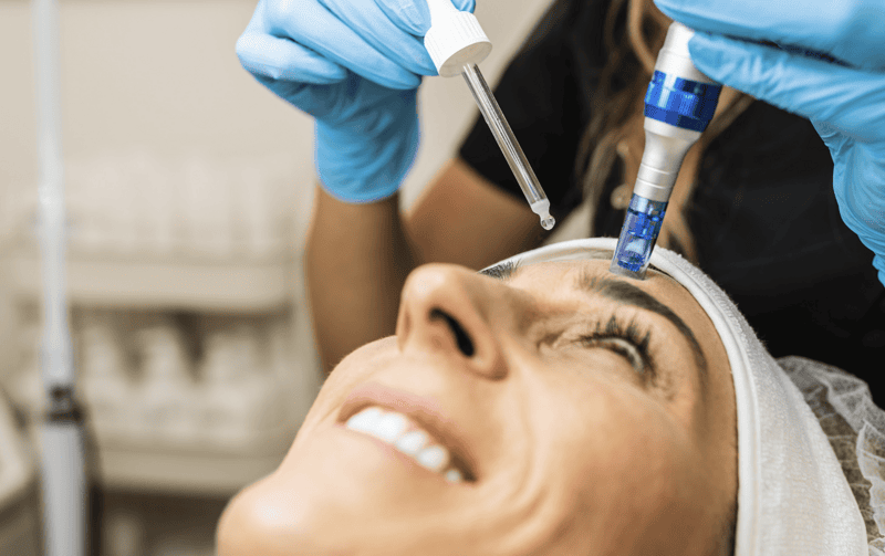 microneedling
