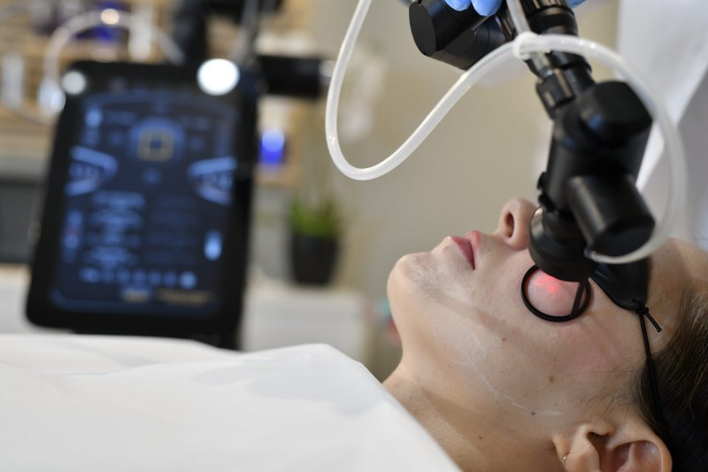 SkinPen Microneedling, C02 laser