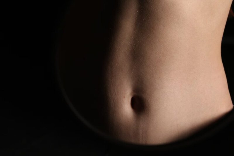 Tummy Tuck