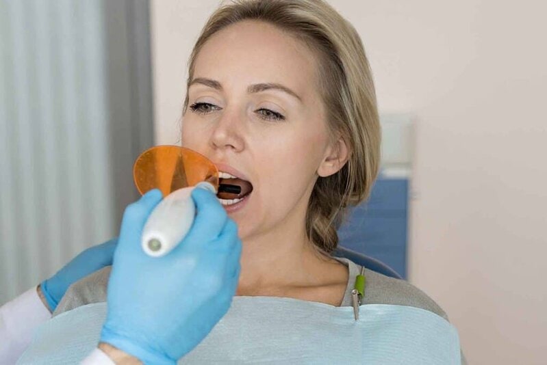 What are the Available Materials for Tooth Filling? 2 what are the advantages of composite filling