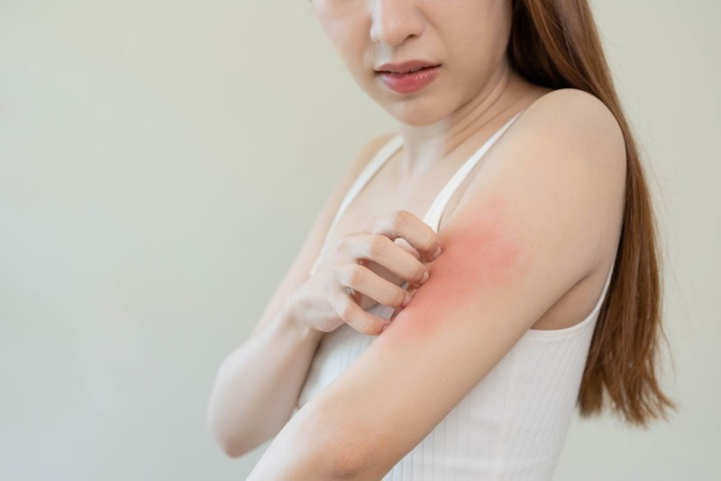 allergic